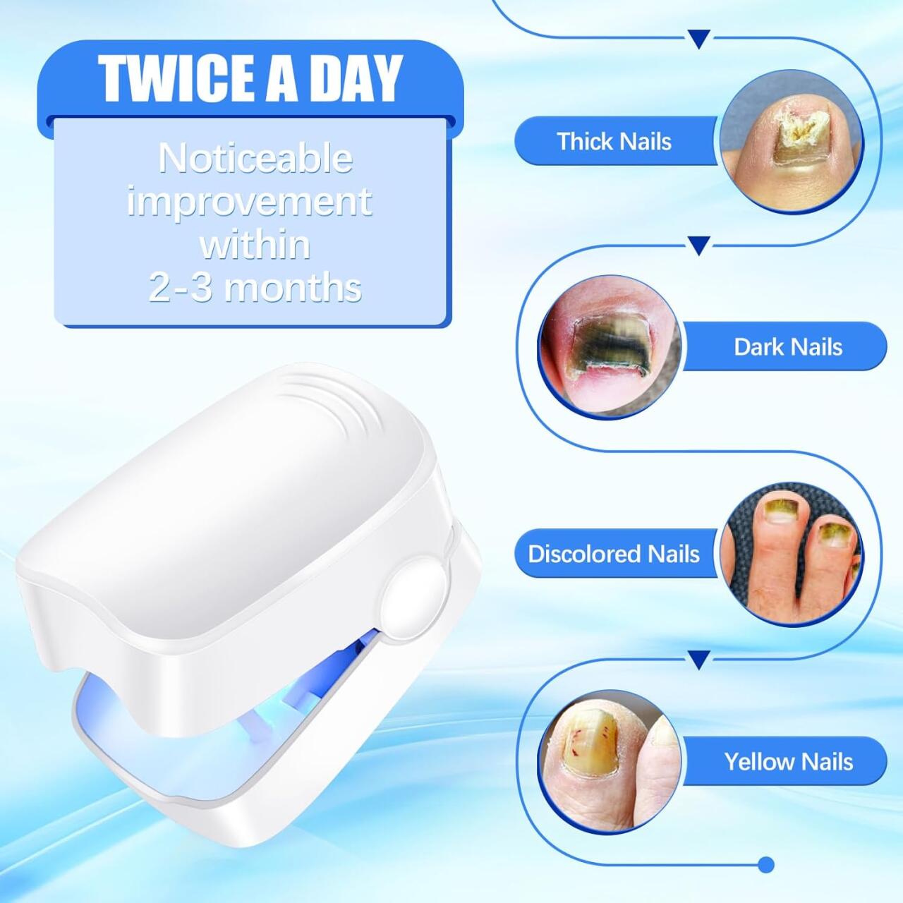 Dispositivo Láser para Tratamiento de Hongos Uñas