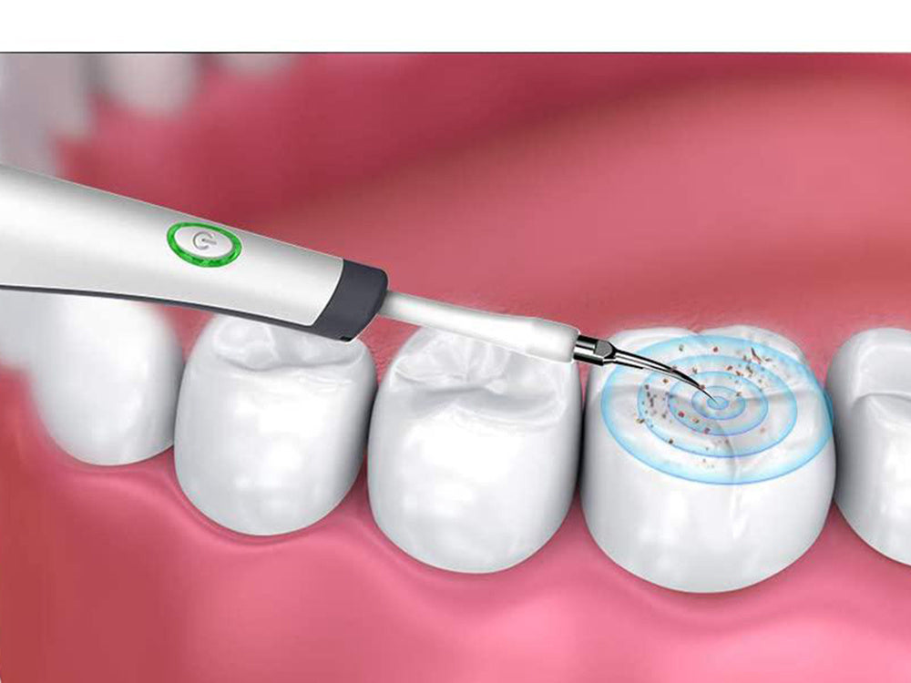 Cepillo Ultrasonico Dental