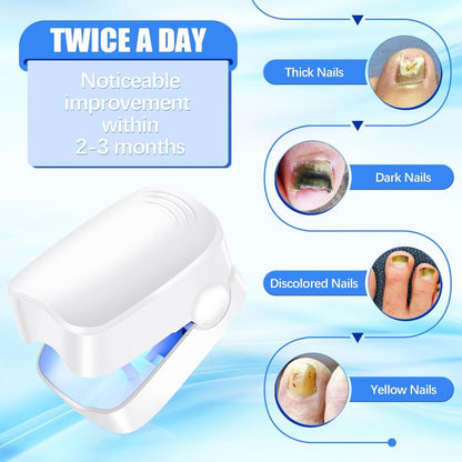 Dispositivo Láser para Tratamiento de Hongos Uñas
